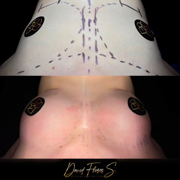 Slider image (6) Dr. David Flores Soto - DFS Plastic Surgery
